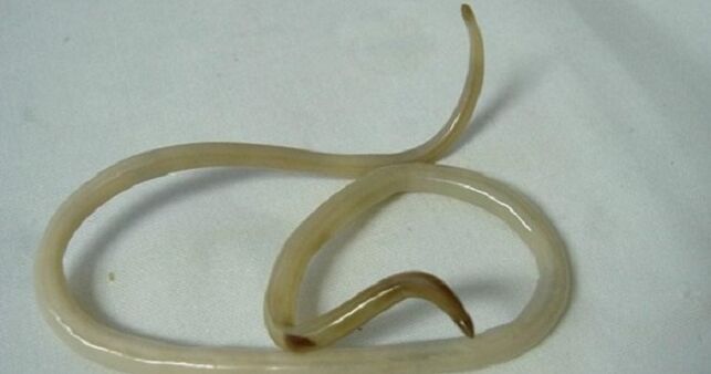 parasitic worm from the body of a child