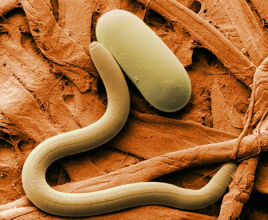 Parasite under the microscope