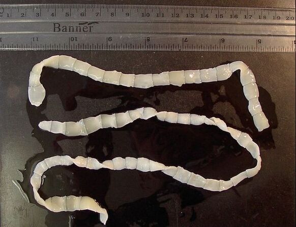 large tapeworm from the human body
