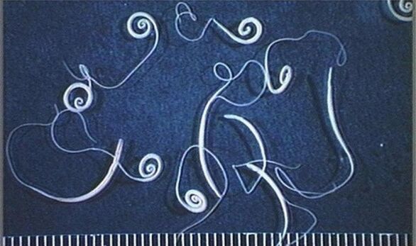 whipworms from the human body