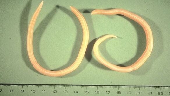 Roundworms are worms that manifest themselves with tiredness and coughing.