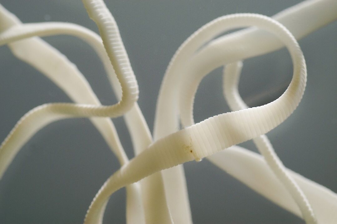 human nematode worm