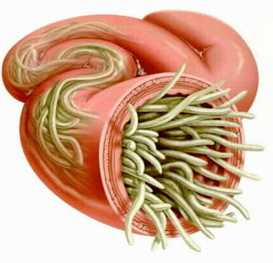 roundworms in the human intestine